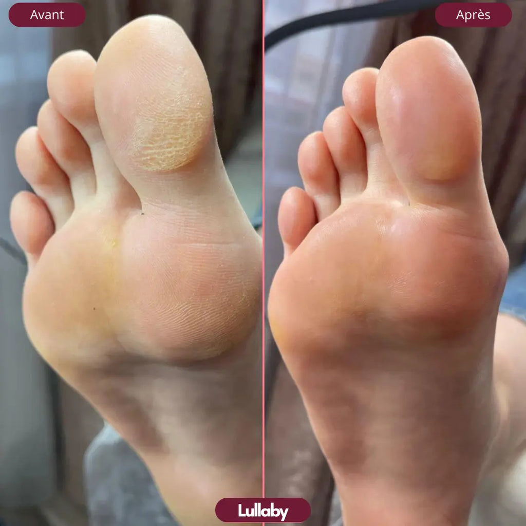 Lullaby™ GlowStep