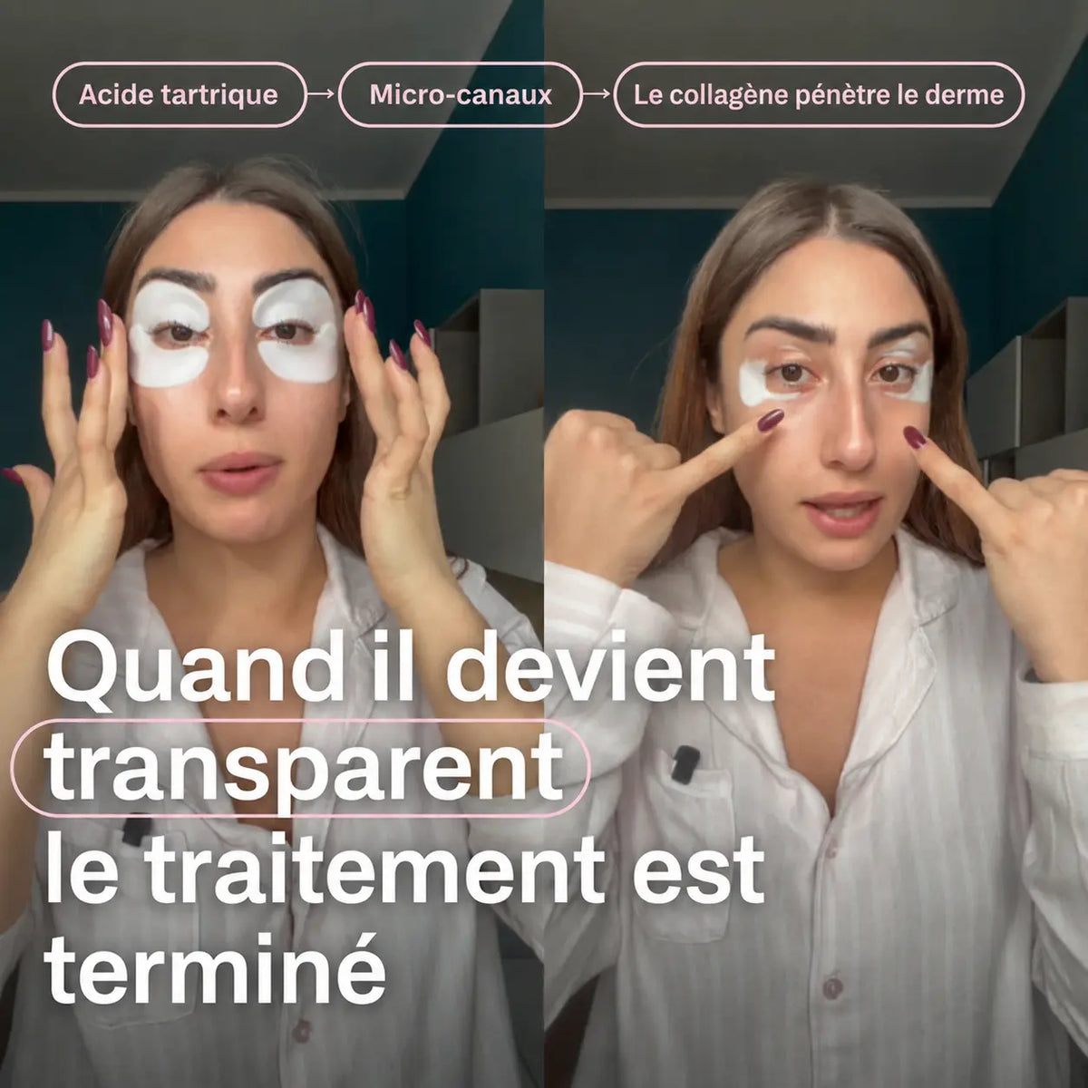 Patch Effet Lifting