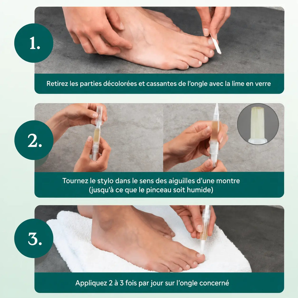 Stylo NailCare - Soin des Ongles Anti-Mycose